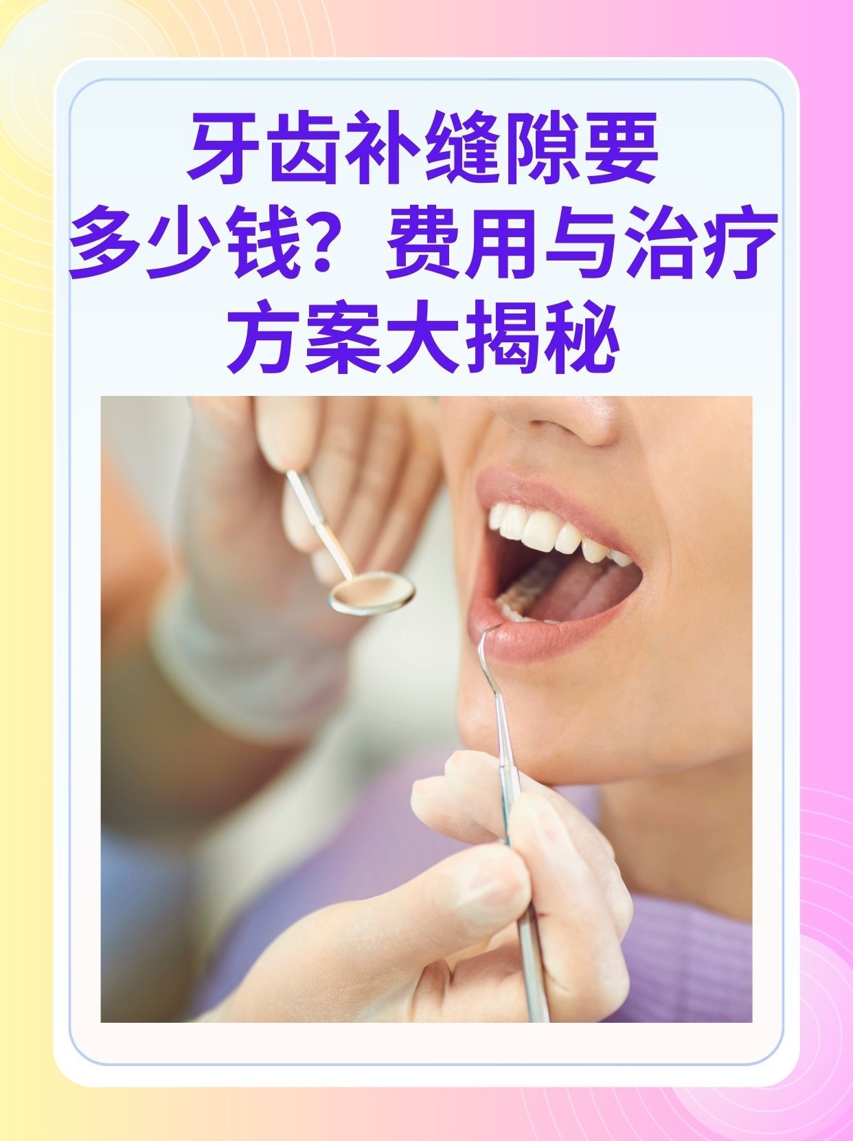 随州补牙医保可以报销吗(补牙医保可以报销吗 哪些可以报销呢)